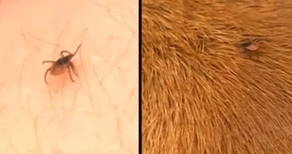 Was hilft gegen Zecken? Diese 3 Dinge helfen bei einer Zecke (Hund, Katze und Mensch)