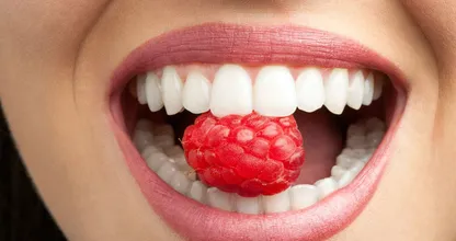 Deze 6 voedingsmiddelen veroorzaken gaatjes in je gebit