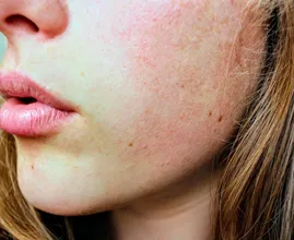 3x natuurlijke maskers om je huid jonger te maken
