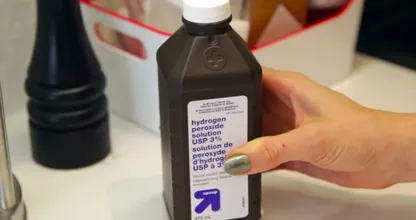 Met dit zelfgemaakte middeltje kom je snel van kalknagels af