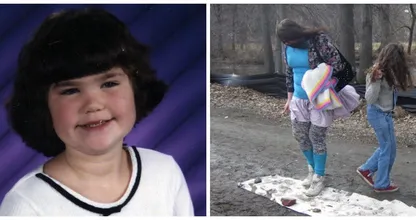 Dit 12-jarige meisje werd door haar klasgenoten 'monster' genoemd, maar moet je haar 15 jaar later eens zien...