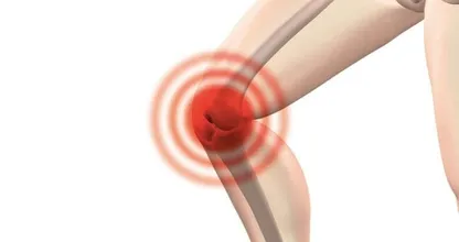 Do you have snapping knees? This is what it means and how you might fix it