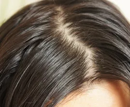 Wird dein Haar auch so unglaublich schnell fettig? DARAN kann es liegen und DAS kannst du dagegen tun!