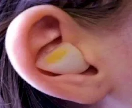 Das verblüffende passiert wenn du den Kern von Zwiebeln nachts auf dein Ohr klemmst.
