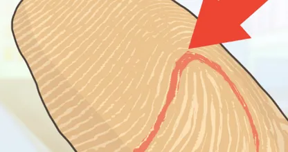 Je vingerafdrukken vertellen veel over je persoonlijkheid! Hoe zien die van jou eruit?