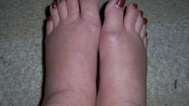 She retained a lot of water in her feet but that disappeared after following these 6 tricks!