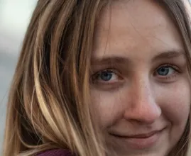 Do you have bags under your eyes? This might be making it worse