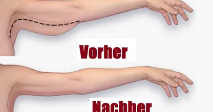 Hast du auch 'Schwabbelarme'? Diese 3-Minuten-Übung hilft wirklich.