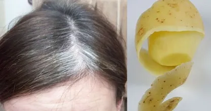 ¿Tienes canas? Entonces deberías hacer esto con rebanadas de papa