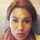 Patty Brard moet in december onder het mes... "Pas nu weet ik hoe ontzettend veel pijn een mens kan hebben"