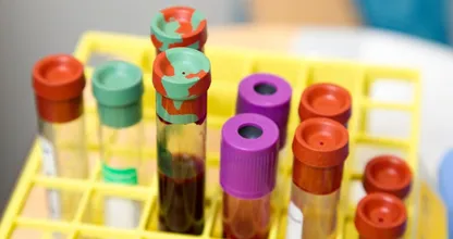 Dit is waarom het coronavirus minder dodelijk is voor vrouwen dan voor mannen