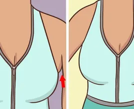 Você tem gordura nas axilas saindo do seu sutiã? Isto é o que você pode fazer sobre isso