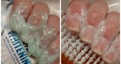 Sie schmiert sich Zahnpasta auf die Fingernägel und das Ergebnis ist unglaublich