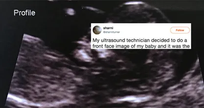 OMG! Deze moeder schrok zich kapot toen ze déze echo van haar kindje zag