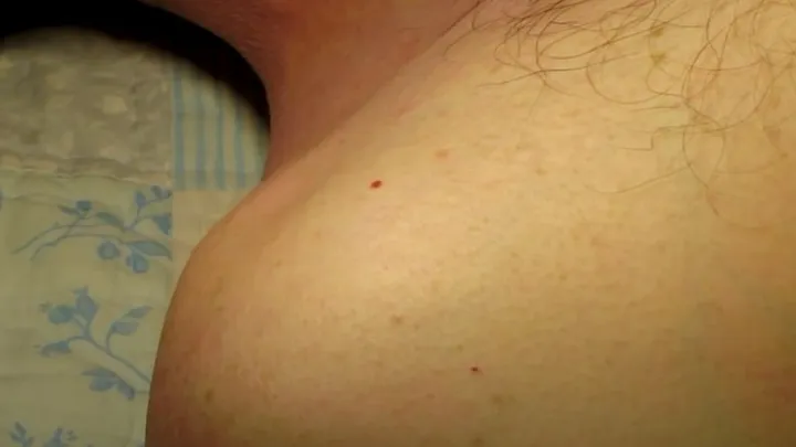 Dermatologues : Voici comment enlever ces "grains de beauté" rouges