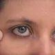 Cette astuce vous permet de vous débarrasser vous-même du milium