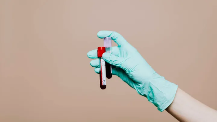Onderzoek toont aan: voor het eerst plastic deeltjes gevonden in menselijk bloed
