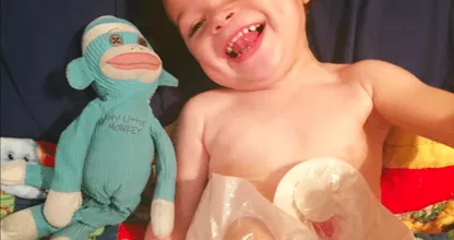 Een voorbijganger noemt haar zoontje met stoma 'walgelijk' en haar reactie is fantastisch!