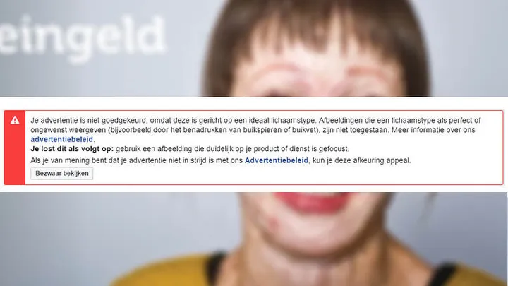 BIZAR: deze advertentie van Brandwonden Stichting wordt geweigerd op Facebook!