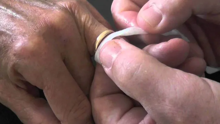 Zo krijg je een vastzittende ring los zónder de ring kapot te maken!