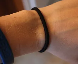 WARNING: Do you wear hair ties around your wrist? You'd better stop! It's really dangerous!