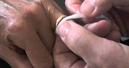 Zo krijg je een vastzittende ring los zónder de ring kapot te maken!