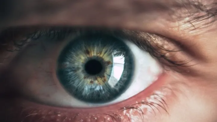 Eye migraines: these are the symptoms and how you might be able to reduce them