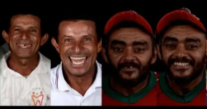 Braziliaanse tandarts helpt arme mensen gratis met nieuw gebit