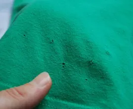 Haben deine Klamotten auch manchmal diese kleinen komischen Löcher? HIERDURCH kommt das!