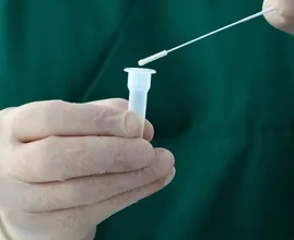 Het gaat de goede kant op met de coronacijfers: ze blijven dalen