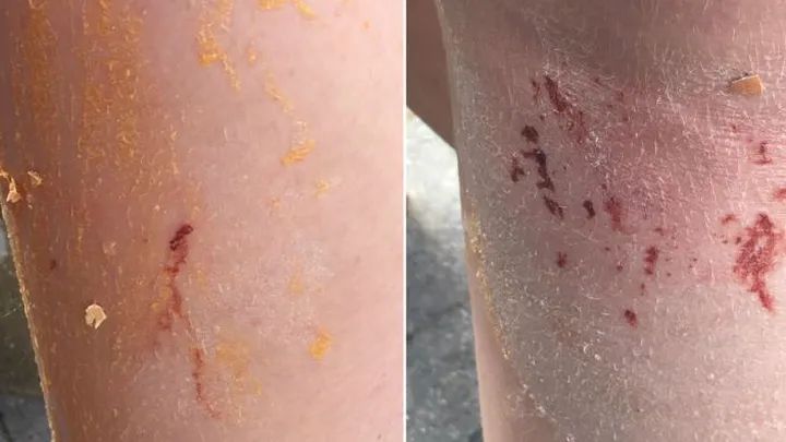 OPROEP: meerdere kinderen tot bloedens toe bekogeld met eieren, daders gezocht! Heb jij iets gezien of gehoord? Delen svp!