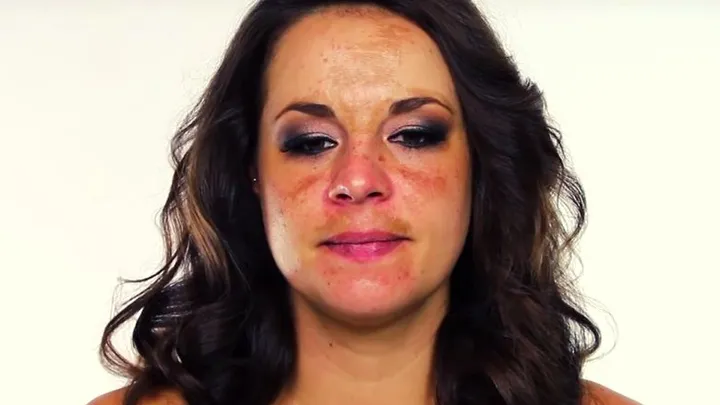 Pigment mustache: with these tips you can remove discoloration above the lip