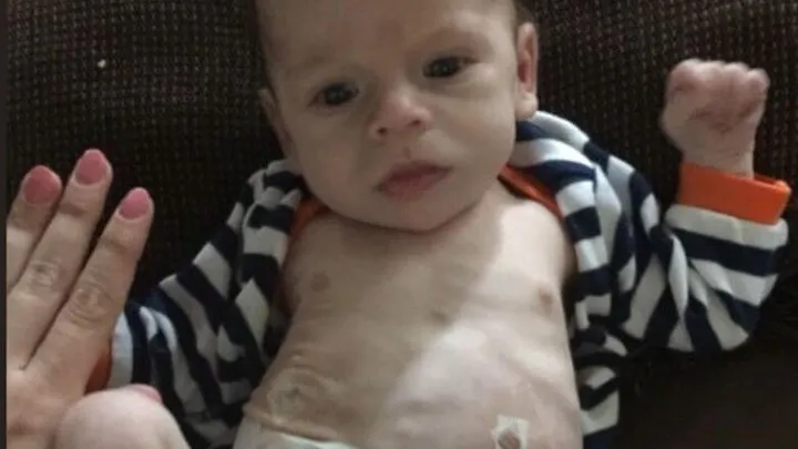 Deze arme baby werd geboren met een drugsverslaving en was doodziek... Maar moet je hem nu zien!
