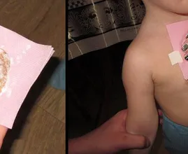Schmiere DAS hier auf die Brust bevor du schlafen gehst und du wirst am nächsten Tag nicht mehr husten müssen!