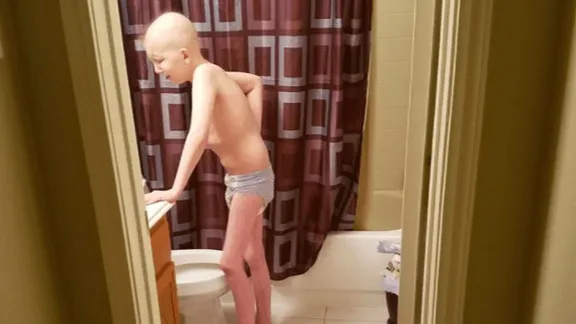 HEFTIG: deze moeder deelt een hartverscheurende foto van haar zieke zoon: "Dit doet kanker met een mens"