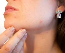 Diese 10 ungewöhnliche Nutzen von Aspirin kannten wir noch nicht!