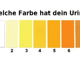 DAS sagt die Farbe deines Urins über deine Gesundheit aus! Das solltest du wissen!
