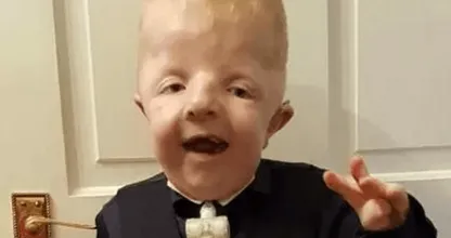 Foto van gehandicapte zoon misbruikt voor likes op Facebook: "Het is gewoon misselijkmakend"