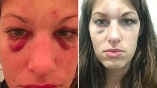 Deze vrouw wordt in elkaar geslagen door haar buurman en ZO gaat de politie ermee om.. Dit is toch schandalig? Delen svp!