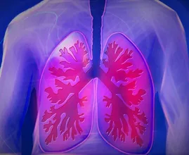 Todos deben conocer este sutil síntoma de cáncer de pulmón