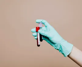 Onderzoek toont aan: voor het eerst plastic deeltjes gevonden in menselijk bloed