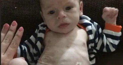 Deze arme baby werd geboren met een drugsverslaving en was doodziek... Maar moet je hem nu zien!