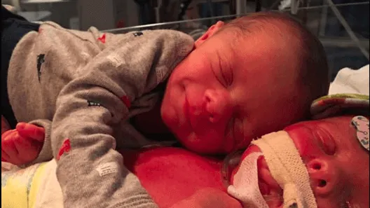 Pasgeboren baby knuffelt stervend tweelingbroertje:  "Hij strekte zijn armpje uit in een omhelzing. Alsof ze wisten dat ze er voor elkaar waren."