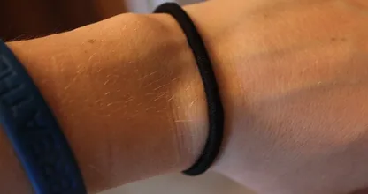 WARNING: Do you wear hair ties around your wrist? You'd better stop! It's really dangerous!