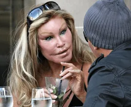 So sah Jocelyn „Catwoman“ Wildenstein vor den ganzen Schönheits-OPs aus! Erkennst du sie wieder?