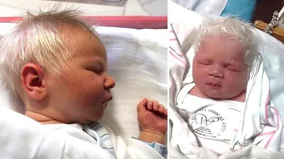 Deze bijzondere baby werd geboren met sneeuwwit haar, heb je ooit zoiets gezien?