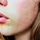 10x coisas comuns diárias que podem fazer com que sua pele envelheça