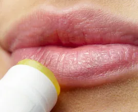 Du denkst Lippenbalsam schützt aber eigentlich macht es alles nur schlimmer!