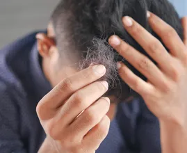 Aha: dit is hoe kaalheid ontstaat