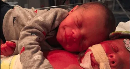 Pasgeboren baby knuffelt stervend tweelingbroertje:  "Hij strekte zijn armpje uit in een omhelzing. Alsof ze wisten dat ze er voor elkaar waren."